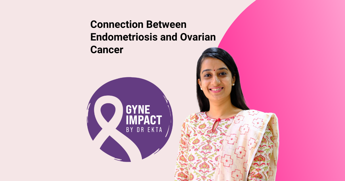 Connection Between Endometriosis and Ovarian Cancer