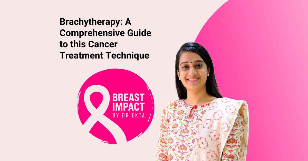 Brachytherapy: A Comprehensive Guide to this Cancer Treatment Technique